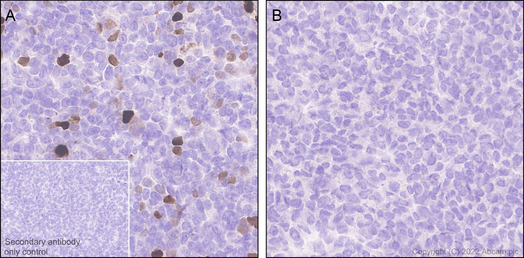 Immunohistochemistry - Anti-INSM1 antibody [EPR23199-37-6-1] (AB305104), expandable thumbnail
