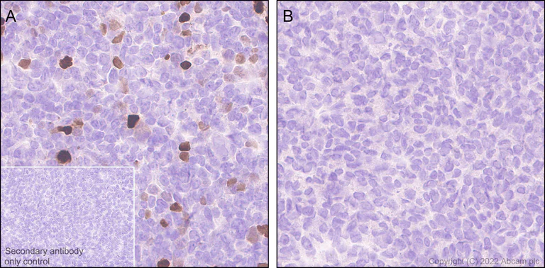 Immunohistochemistry - Anti-INSM1 antibody [EPR23199-37-6-1] (AB305104)
