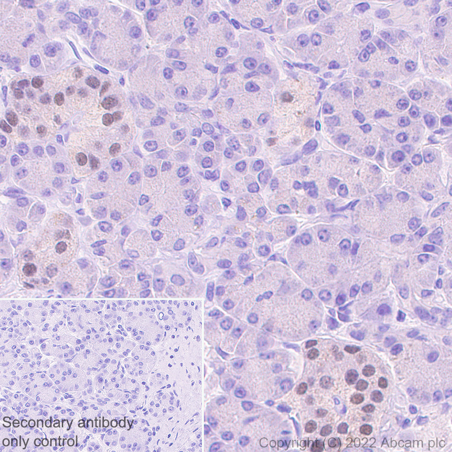 Immunohistochemistry - Anti-INSM1 antibody [EPR23199-37-6-1] (AB305104), expandable thumbnail