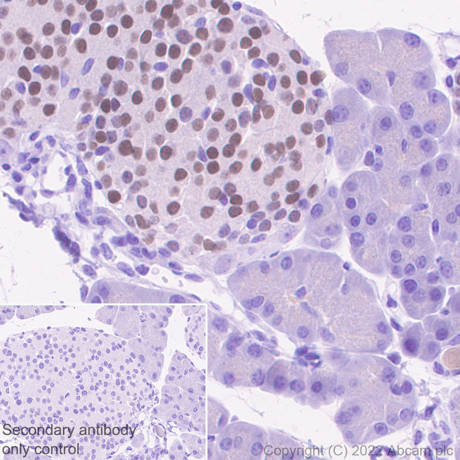 Immunohistochemistry - Anti-INSM1 antibody [EPR23199-37-6-1] (AB305104), expandable thumbnail