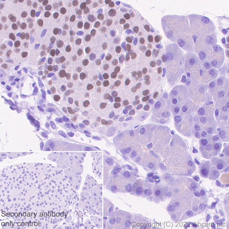 Immunohistochemistry - Anti-INSM1 antibody [EPR23199-37-6-1] (AB305104)