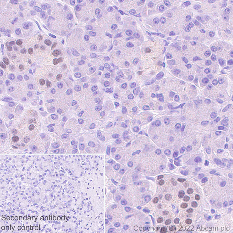 Immunohistochemistry - Anti-INSM1 antibody [EPR23199-37-6-1] - BSA and Azide free (AB305073)