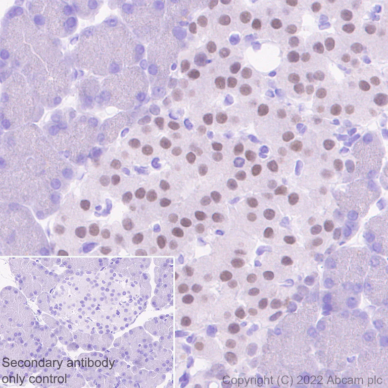 Immunohistochemistry - Anti-INSM1 antibody [EPR23199-37-6-1] - BSA and Azide free (AB305073)