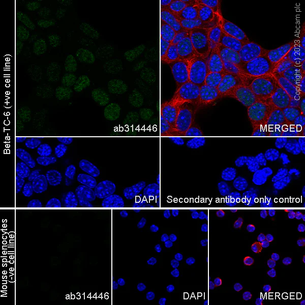 Immunocytochemistry/ Immunofluorescence - Anti-INSM1 antibody [EPR28316-7] - BSA and Azide free (AB314447)