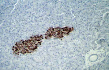 Immunohistochemistry (Formalin/PFA-fixed paraffin-embedded sections) - Anti-Insulin antibody [E2E3] (AB9569)