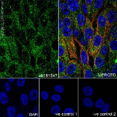 Immunocytochemistry/ Immunofluorescence - Anti-Insulin antibody [EPR17359] (AB181547)