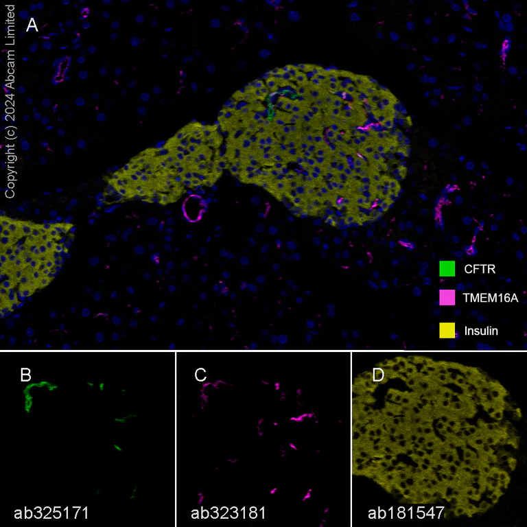 Multiplex immunohistochemistry - Anti-Insulin antibody [EPR17359] (AB181547)