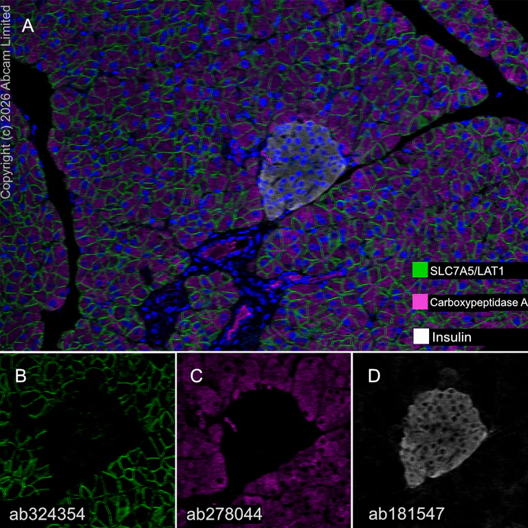 Multiplex immunohistochemistry - Anti-Insulin antibody [EPR17359] (AB181547)