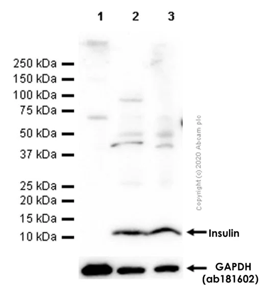 Western blot - Anti-Insulin antibody [EPR17359] (AB181547)