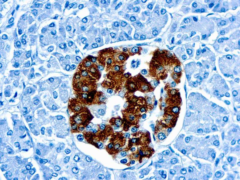 Immunohistochemistry (Formalin/PFA-fixed paraffin-embedded sections) - Anti-Insulin antibody [K36aC10] (AB6995), expandable thumbnail