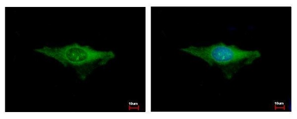 Immunocytochemistry/ Immunofluorescence - Anti-Insulin degrading enzyme / IDE antibody (AB228720), expandable thumbnail