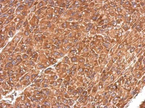 Immunohistochemistry (Formalin/PFA-fixed paraffin-embedded sections) - Anti-Insulin degrading enzyme / IDE antibody (AB228720), expandable thumbnail