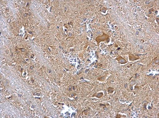 Immunohistochemistry (Formalin/PFA-fixed paraffin-embedded sections) - Anti-Insulin degrading enzyme / IDE antibody (ab228720), expandable thumbnail