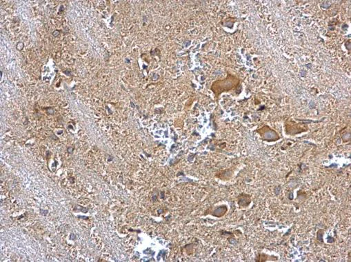 Immunohistochemistry (Formalin/PFA-fixed paraffin-embedded sections) - Anti-Insulin degrading enzyme / IDE antibody (AB228720)