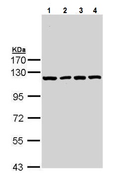 Western blot - Anti-Insulin degrading enzyme / IDE antibody (ab228720), expandable thumbnail