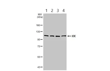 Western blot - Anti-Insulin degrading enzyme / IDE antibody (AB228720)