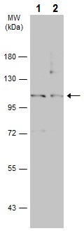 Western blot - Anti-Insulin degrading enzyme / IDE antibody (AB228720), expandable thumbnail