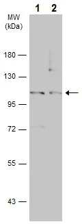 Western blot - Anti-Insulin degrading enzyme / IDE antibody (AB228720)