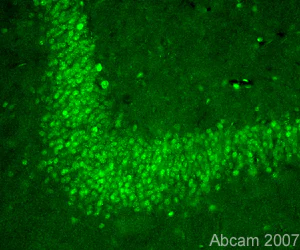 Immunohistochemistry (PFA perfusion fixed frozen sections) - Anti-Insulin degrading enzyme / IDE antibody (AB32216)