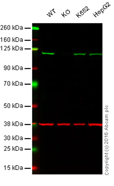 Western blot - Anti-Insulin degrading enzyme / IDE antibody (AB32216)