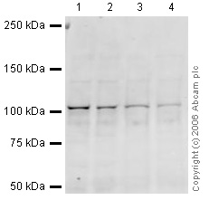 Western blot - Anti-Insulin degrading enzyme / IDE antibody (AB32216), expandable thumbnail