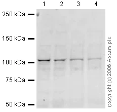 Western blot - Anti-Insulin degrading enzyme / IDE antibody (AB32216)