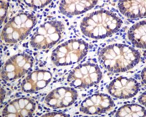 Immunohistochemistry (Formalin/PFA-fixed paraffin-embedded sections) - Anti-Insulin degrading enzyme / IDE antibody [EPR6098(2)] (AB133561)