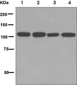 Western blot - Anti-Insulin degrading enzyme / IDE antibody [EPR6098(2)] (AB133561)