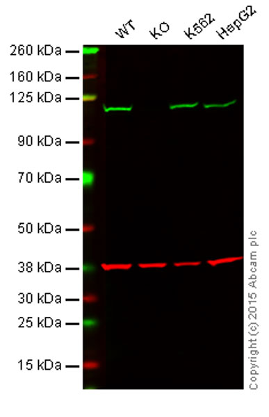 Western blot - Anti-Insulin degrading enzyme / IDE antibody [EPR6098(2)] (AB133561), expandable thumbnail