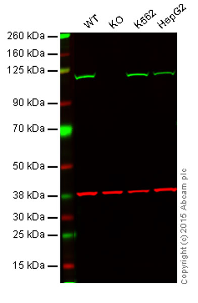 Western blot - Anti-Insulin degrading enzyme / IDE antibody [EPR6099] (AB109538), expandable thumbnail
