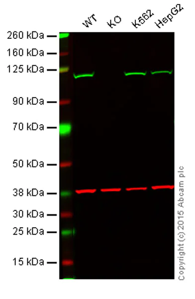 Western blot - Anti-Insulin degrading enzyme / IDE antibody [EPR6099] (AB109538)