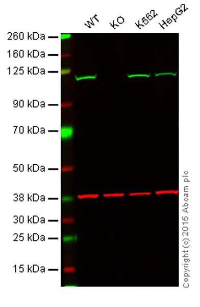 Western blot - Anti-Insulin degrading enzyme / IDE antibody [EPR6099] - BSA and Azide free (AB247897)