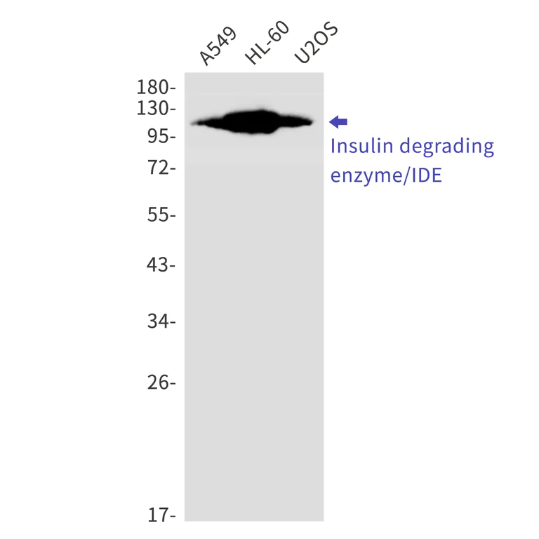 Western blot - Anti-Insulin degrading enzyme / IDE Antibody [S04-4E8] (AB317428)