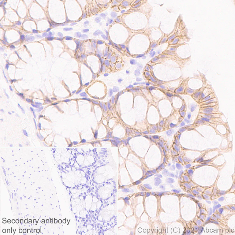 Immunohistochemistry (Formalin/PFA-fixed paraffin-embedded sections) - Anti-Insulin Receptor alpha antibody [EPR23962-157] (AB283689)