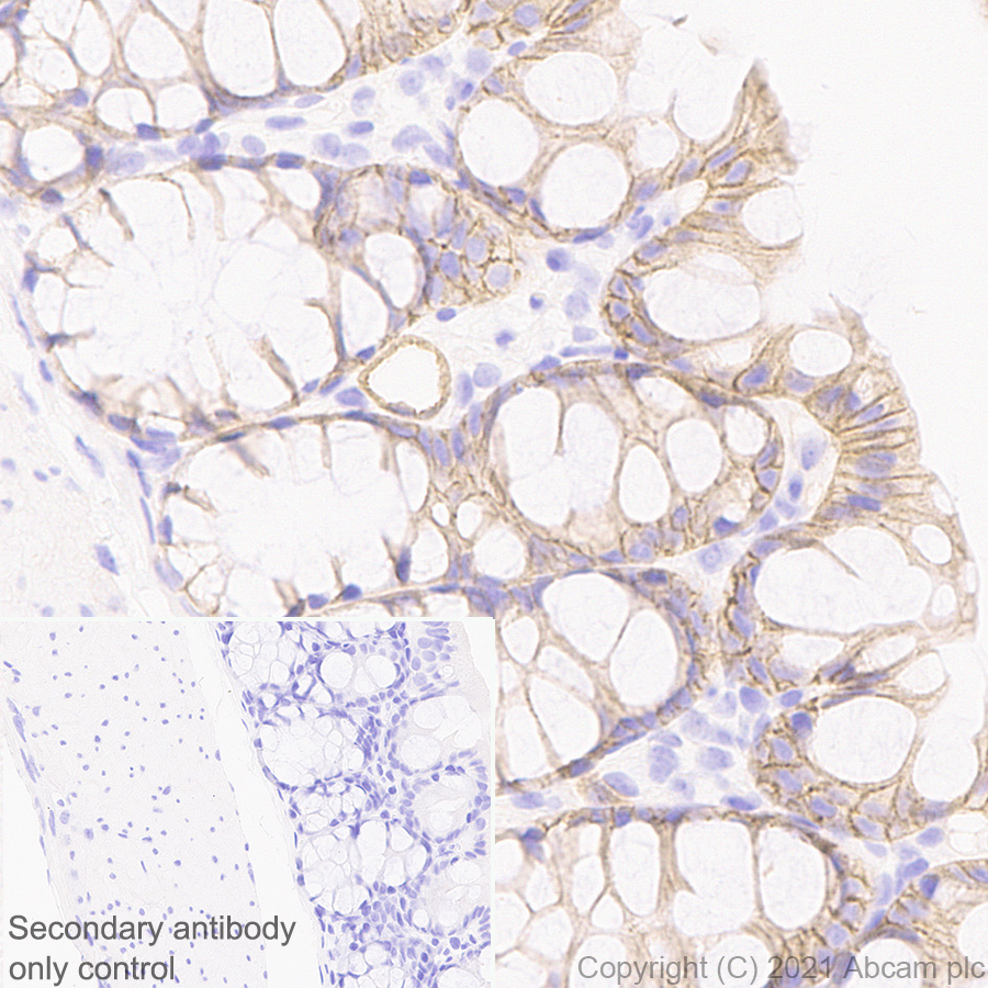 Immunohistochemistry (Formalin/PFA-fixed paraffin-embedded sections) - Anti-Insulin Receptor alpha antibody [EPR23962-157] - BSA and Azide free (ab283717), expandable thumbnail