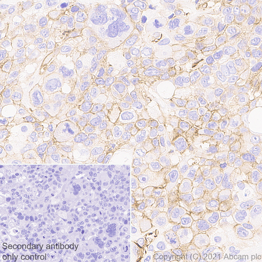 Immunohistochemistry (Formalin/PFA-fixed paraffin-embedded sections) - Anti-Insulin Receptor alpha antibody [EPR23962-157] - BSA and Azide free (AB283717), expandable thumbnail