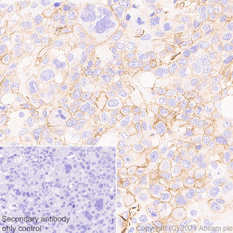 Immunohistochemistry (Formalin/PFA-fixed paraffin-embedded sections) - Anti-Insulin Receptor alpha antibody [EPR23962-157] - BSA and Azide free (AB283717)
