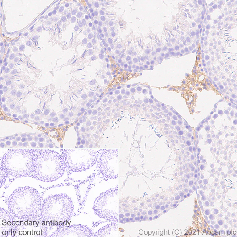 Immunohistochemistry (Formalin/PFA-fixed paraffin-embedded sections) - Anti-Insulin Receptor alpha antibody [EPR23962-157] - BSA and Azide free (AB283717)