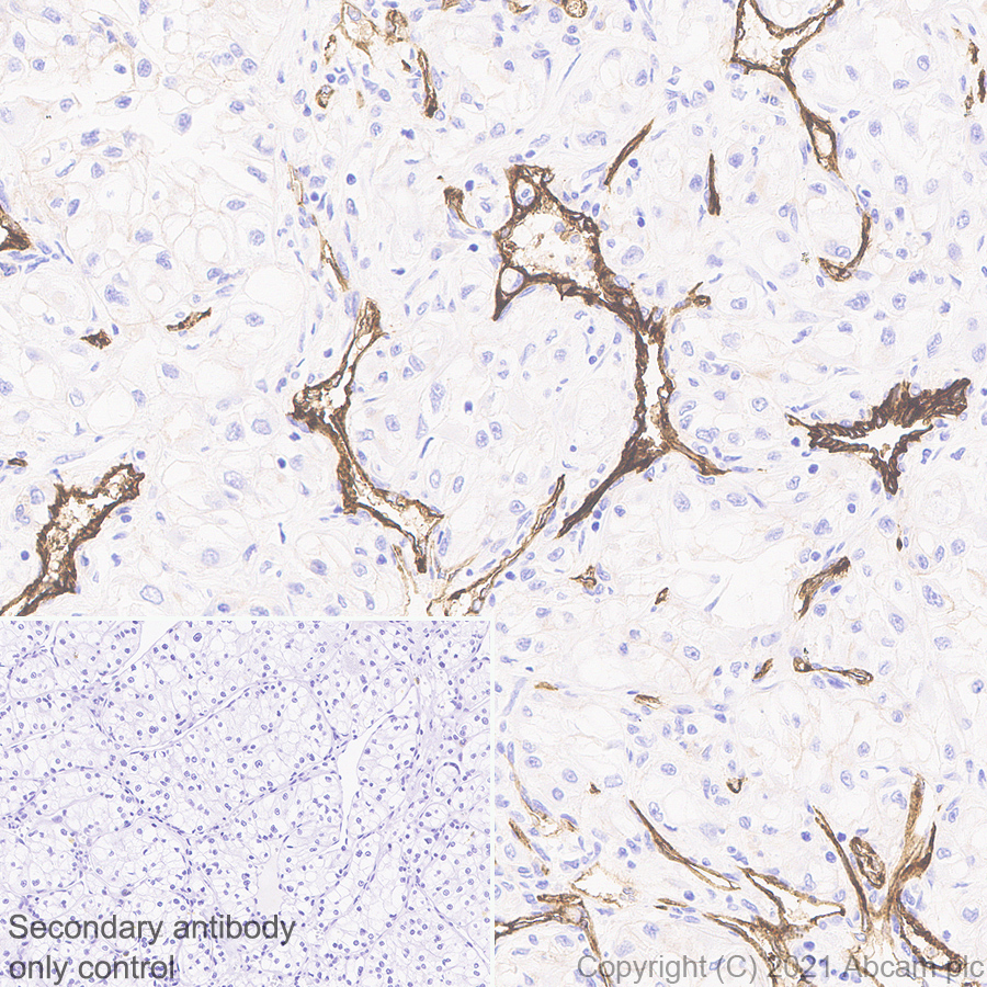 Immunohistochemistry (Formalin/PFA-fixed paraffin-embedded sections) - Anti-Insulin Receptor alpha antibody [EPR23962-157] - BSA and Azide free (AB283717), expandable thumbnail