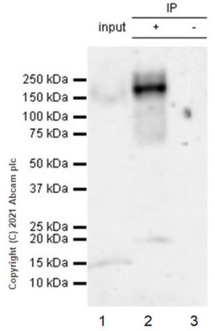 Immunoprecipitation - Anti-Insulin Receptor alpha antibody [EPR23962-157] - BSA and Azide free (ab283717), expandable thumbnail