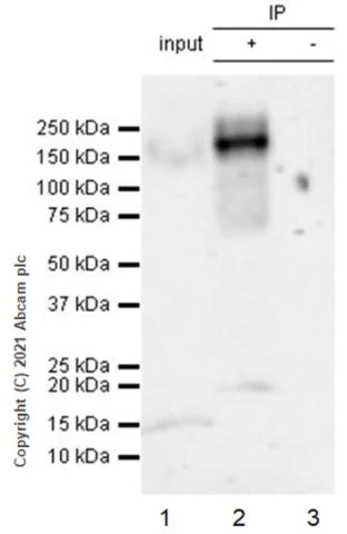 Immunoprecipitation - Anti-Insulin Receptor alpha antibody [EPR23962-157] - BSA and Azide free (AB283717)
