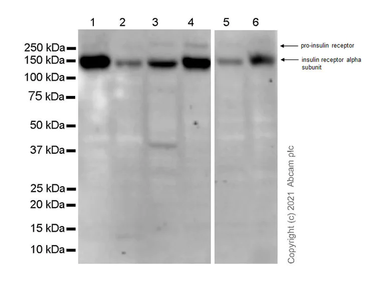 Western blot - Anti-Insulin Receptor alpha antibody [EPR23962-157] - BSA and Azide free (AB283717)