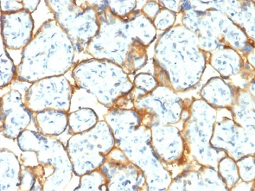 Immunohistochemistry (Formalin/PFA-fixed paraffin-embedded sections) - Anti-Insulin Receptor alpha antibody [INSR/2277R] (AB236493)