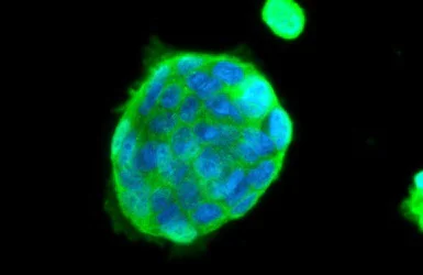 Immunocytochemistry/ Immunofluorescence - Anti-Insulin Receptor antibody (AB137747)