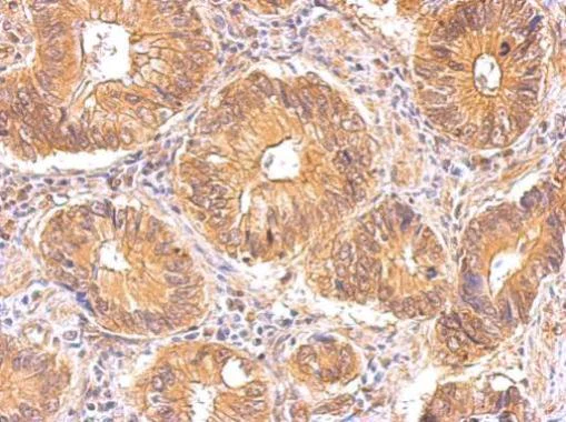 Immunohistochemistry (Formalin/PFA-fixed paraffin-embedded sections) - Anti-Insulin Receptor antibody (AB137747)