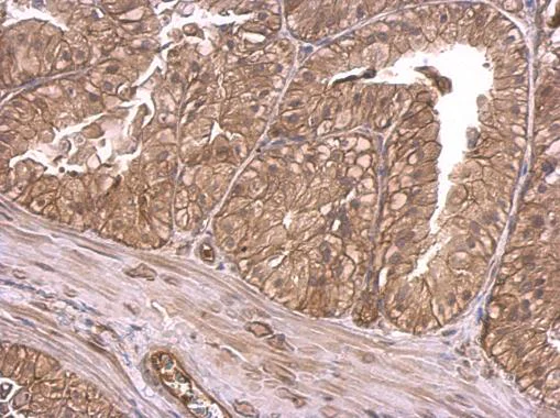 Immunohistochemistry (Formalin/PFA-fixed paraffin-embedded sections) - Anti-Insulin Receptor antibody (AB137747)