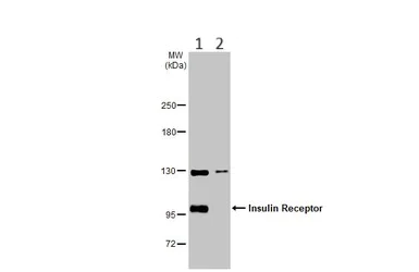 Western blot - Anti-Insulin Receptor antibody (AB137747)