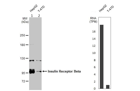 Western blot - Anti-Insulin Receptor antibody (AB137747)