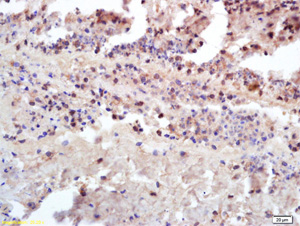 Immunohistochemistry (Formalin/PFA-fixed paraffin-embedded sections) - Anti-Insulin Receptor antibody (AB203746)
