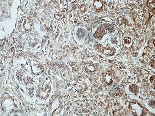 Immunohistochemistry (Formalin/PFA-fixed paraffin-embedded sections) - Anti-Insulin Receptor antibody (AB206849)